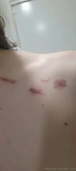 Ren Uwu OnlyFans Leaked Free Thumbnail Picture - #xsjXoMPDHg