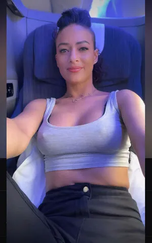 Rocking Alopecia OnlyFans Leaked Free Thumbnail Picture - #SeS9sGgJOT