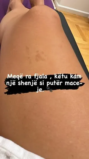 Rudina Dembacaj OnlyFans Leaked Free Thumbnail Picture - #mZAsjyF5HE