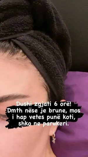 Rudina Dembacaj OnlyFans Leaked Free Thumbnail Picture - #nGa8VJmxdG