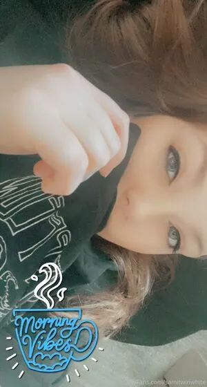 Samitwinwhite OnlyFans Leaked Free Thumbnail Picture - #Jby7IjMFAx