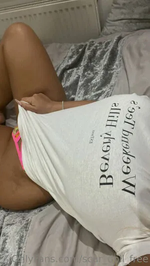 Scar Doll Free OnlyFans Leaked Free Thumbnail Picture - #W9EzpOak84