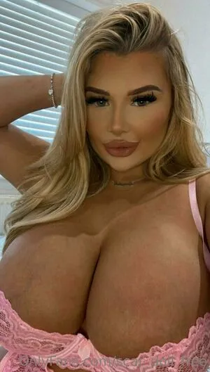 Scar Doll Free OnlyFans Leaked Free Thumbnail Picture - #xoBv6XjhZl