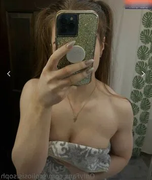 Scoliosis Soph OnlyFans Leaked Free Thumbnail Picture - #2Yt1Gwt4oZ