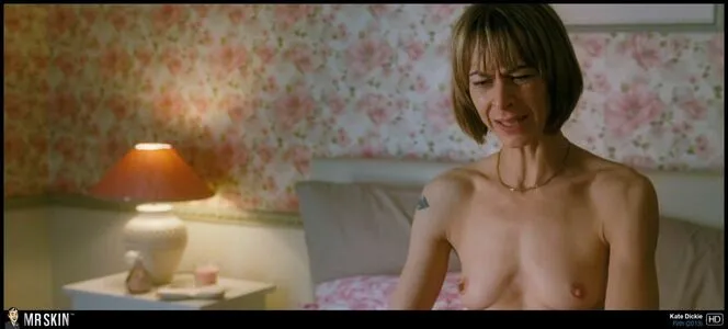 Scottish OnlyFans Leaked Free Thumbnail Picture - #ldo0ortev1