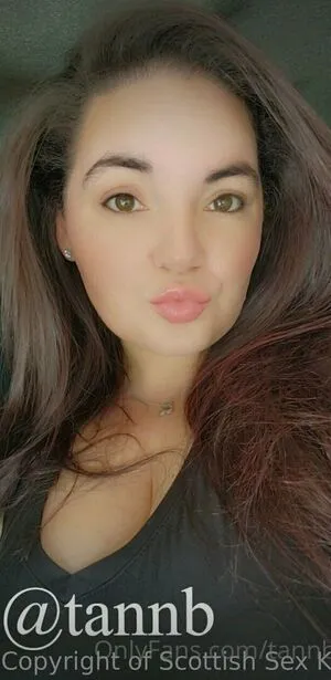 Scottishsexkitten OnlyFans Leaked Free Thumbnail Picture - #N6sHVhoHDf