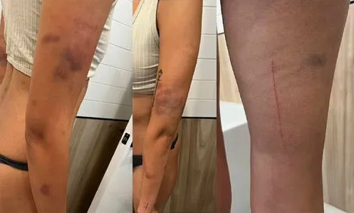 Sienna Hubert Ross OnlyFans Leaked Free Thumbnail Picture - #ypdYRmoJIh