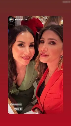 Sila Sahin Radlinger OnlyFans Leaked Free Thumbnail Picture - #5QGBVsDoeM