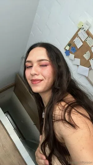 Skarlethpoison OnlyFans Leaked Free Thumbnail Picture - #dNdVPKgvbU