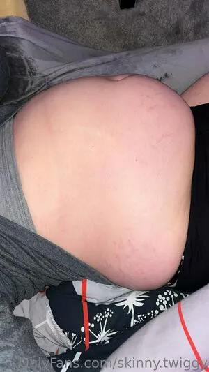 Skinny Twiggy OnlyFans Leaked Free Thumbnail Picture - #Cp6jcUNODh