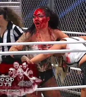 Skye Dolecki OnlyFans Leaked Free Thumbnail Picture - #SL3U00pTMl