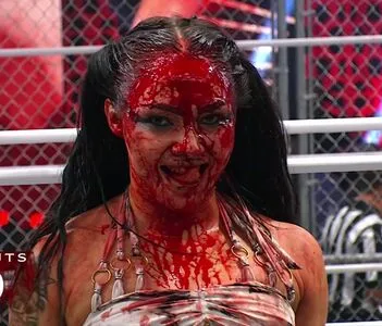 Skye Dolecki OnlyFans Leaked Free Thumbnail Picture - #imhOsjGidb