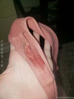 Smolfoxes OnlyFans Leaked Free Thumbnail Picture - #zSAhEigG5S