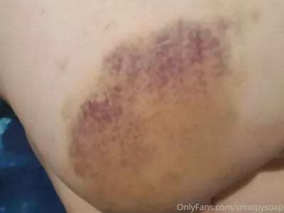 Snoopysoap OnlyFans Leaked Free Thumbnail Picture - #uq11V0dRTl