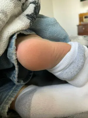Solelydawn OnlyFans Leaked Free Thumbnail Picture - #kKsBl8MLMh