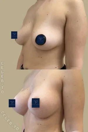 Stefanie Emig OnlyFans Leaked Free Thumbnail Picture - #FArJDDJ4OV