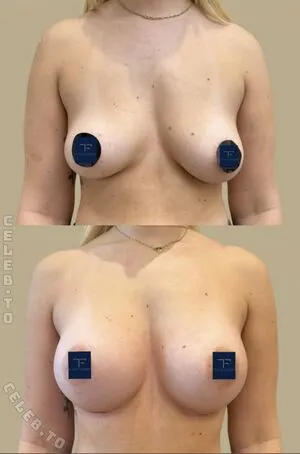 Stefanie Emig OnlyFans Leaked Free Thumbnail Picture - #roOMyVlIgQ