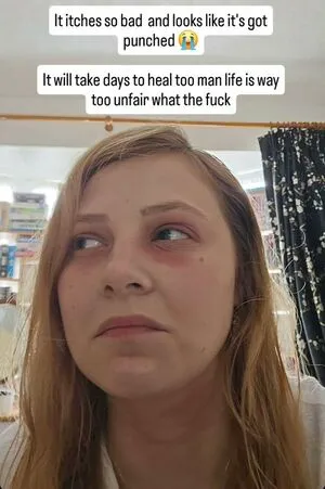 Sydney Poniewaz OnlyFans Leaked Free Thumbnail Picture - #F6zGZUzthp