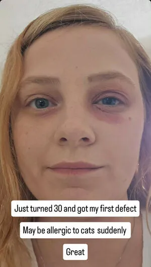Sydney Poniewaz OnlyFans Leaked Free Thumbnail Picture - #hEhmHurAbR