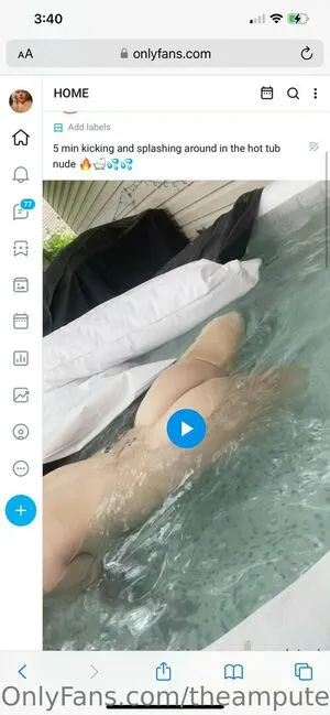 Theamputeebitch OnlyFans Leaked Free Thumbnail Picture - #Weczpyf0ss
