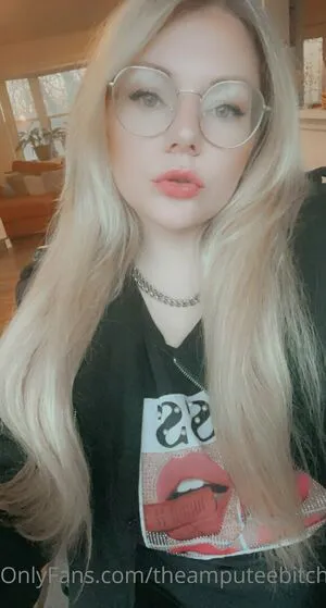 Theamputeebitch OnlyFans Leaked Free Thumbnail Picture - #hzdy5Bpc3c