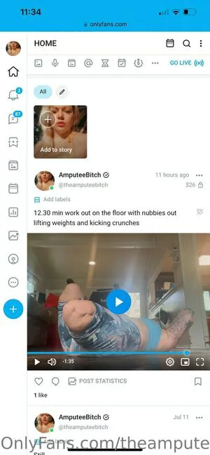 Theamputeebitch OnlyFans Leaked Free Thumbnail Picture - #pzsqssDDAY