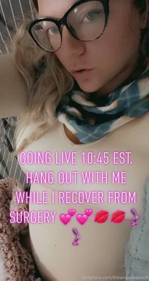 Theamputeebitch OnlyFans Leaked Free Thumbnail Picture - #xK182cgEp2