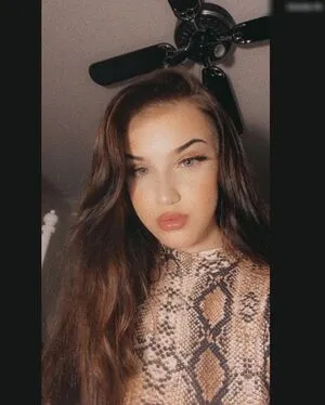 Thisisronjaaa Badbarbie 1312 Ronja Schleweis OnlyFans Leaked Free Thumbnail Picture - #dTnGImOwNp