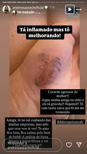 Tretas OnlyFans Leaked Free Thumbnail Picture - #RhwLIUlPk9