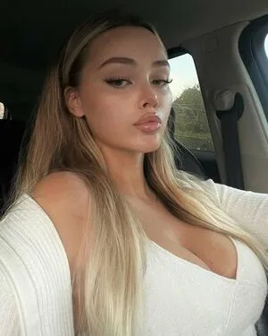 Uresa Zogu OnlyFans Leaked Free Thumbnail Picture - #NgqWOkDtyu