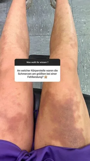 Valea Katharina Scalabrino OnlyFans Leaked Free Thumbnail Picture - #WwZmLgPwxY