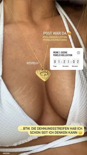 Vanessa Mai OnlyFans Leaked Free Thumbnail Picture - #nYcbpxWr6T