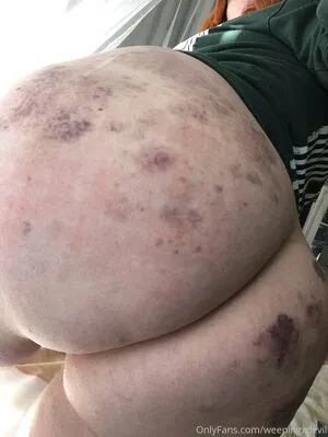 Weepingxdevil OnlyFans Leaked Free Thumbnail Picture - #LEHmI9ckgx
