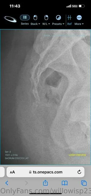 Willowisp23 OnlyFans Leaked Free Thumbnail Picture - #4CRG38Zo8I