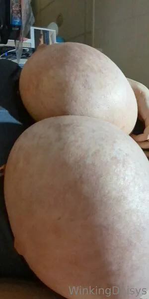 Winkingdaisys OnlyFans Leaked Free Thumbnail Picture - #ocU2j0cBfy