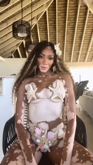 Winnie Harlow OnlyFans Leaked Free Thumbnail Picture - #0AsdMlWWFv