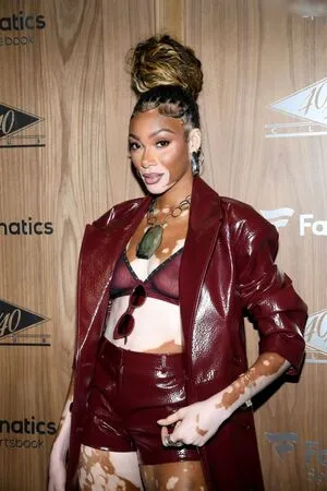 Winnie Harlow OnlyFans Leaked Free Thumbnail Picture - #0F71NdsdDH