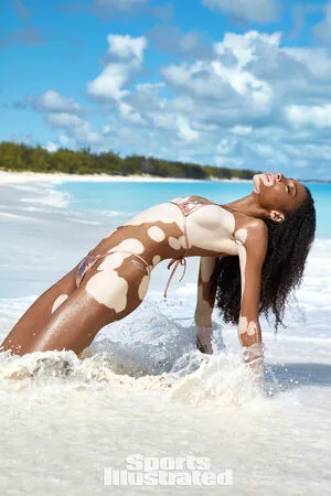 Winnie Harlow OnlyFans Leaked Free Thumbnail Picture - #0PUNeNhi5j