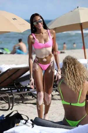 Winnie Harlow OnlyFans Leaked Free Thumbnail Picture - #0SzQp8JB6G