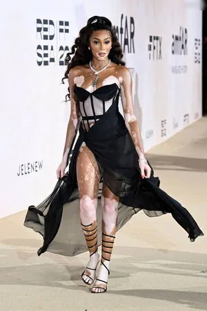 Winnie Harlow OnlyFans Leaked Free Thumbnail Picture - #0ZIACFvyRI
