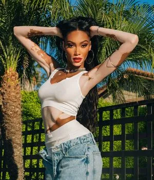 Winnie Harlow OnlyFans Leaked Free Thumbnail Picture - #1h0lQaDG9n