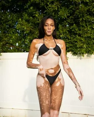 Winnie Harlow OnlyFans Leaked Free Thumbnail Picture - #1yE08IfbIx