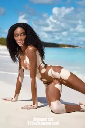 Winnie Harlow OnlyFans Leaked Free Thumbnail Picture - #24m9manHRh