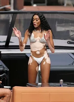 Winnie Harlow OnlyFans Leaked Free Thumbnail Picture - #2BCCAYaYE1