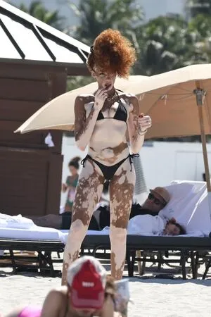 Winnie Harlow OnlyFans Leaked Free Thumbnail Picture - #2D7BfHpQrl