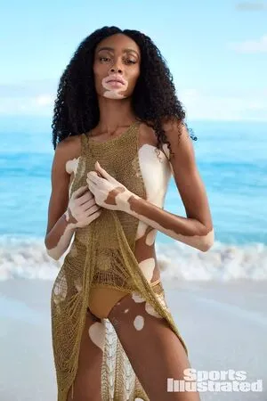 Winnie Harlow OnlyFans Leaked Free Thumbnail Picture - #2H6QpGtqDE
