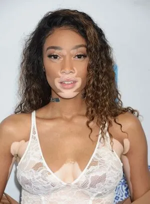 Winnie Harlow OnlyFans Leaked Free Thumbnail Picture - #2Iq5yy1KeM