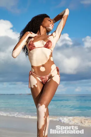 Winnie Harlow OnlyFans Leaked Free Thumbnail Picture - #2bip59VG68