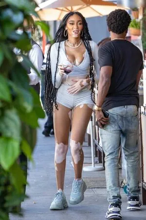 Winnie Harlow OnlyFans Leaked Free Thumbnail Picture - #2oa2CuUTNH