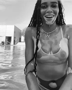 Winnie Harlow OnlyFans Leaked Free Thumbnail Picture - #3FZEPwTyUq